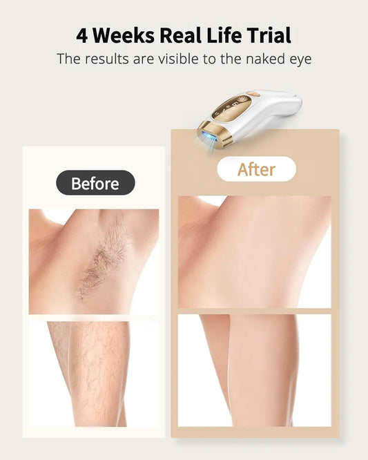 T-Series Unlimited Flashes IPL Laser | Sophisticated "9-Gear" Precision Silhouette | Elegant Ice-Cooling Painless Electric Depilator | "Dignified" High-Performance Hair Removal for Radiant Versatile Styling Luxegan